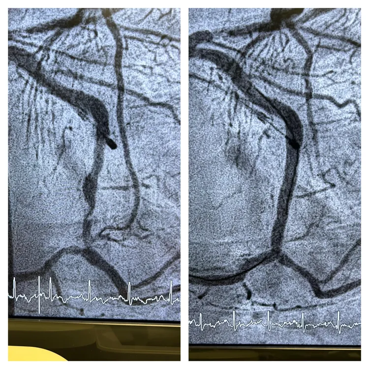 婦人X光照嚇壞醫師。翻攝臉書「冠任醫師的異想世界」