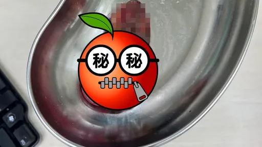 吃消夜腹部剧痛!这器官「肿如士林大香肠」 医师一照超音波:不得了