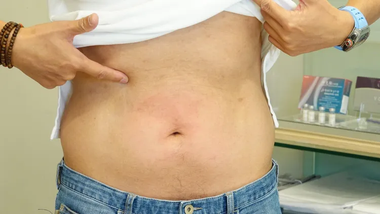 30分鐘療程結束，再次測量數據，腰圍變成82公分，差了7公分，常董摸著腹部笑說：「像是做了5千下懸吊式仰臥起坐！」彭欣偉攝