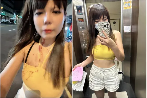 群鶯亂舞濺血！女控遭酒吧小姐嫉妒美貌圍毆　網圍觀看傻眼