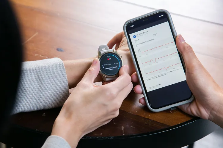 Garmin ECG App 監測分析結果可上傳至Garmin Connect App彙整成完整記錄報告，作為追蹤心臟電活動的依據。業者提供