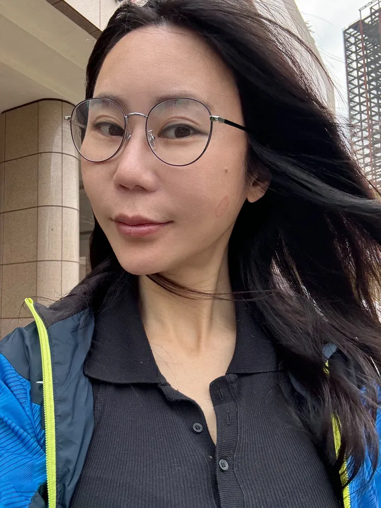 安晨妤近來臉頰細菌感染。開店一二三提供