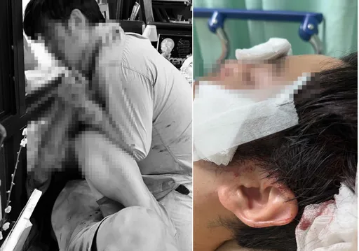 不滿鄰居咖啡店車輛擋道　彰化男怒持刀狂刺顧客！殺人未遂收押