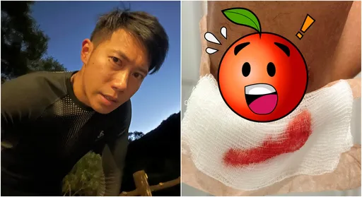 超馬好手陳彥博濺血!背重摔整手血 1動作他秒跪地:慘了