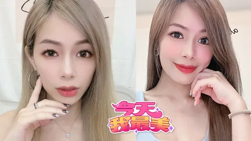 今天我最美｜17主播呦米傻白甜  小虎牙融化少男心