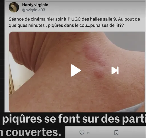 花都巴黎變「臭蟲搖籃」　搭車看電影都被咬滿身包