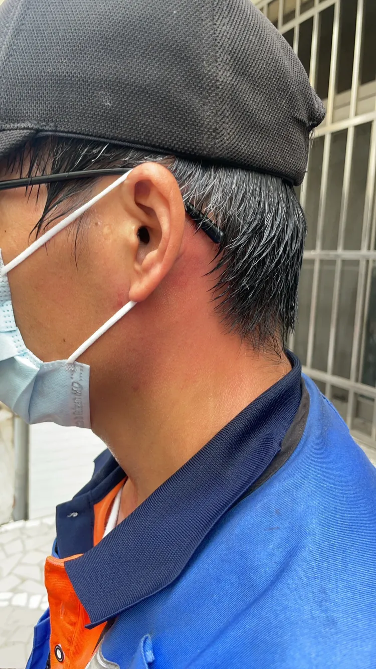 他多處挫傷，已驗傷、提告。消防局提供