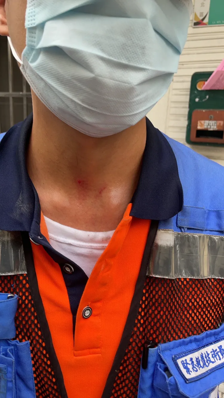 警消頸部也有挫傷。消防局提供