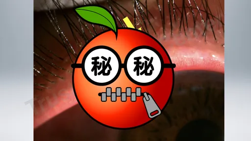 眼皮竟然冒出「2颗鲑鱼卵」 医指这功能出问题!严重恐萎缩