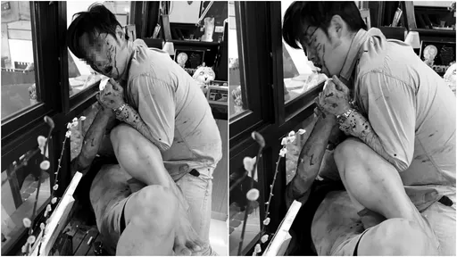 彰化男停車糾紛!持刀殺咖啡館顧客 傷者滿臉鮮血反抗壓制