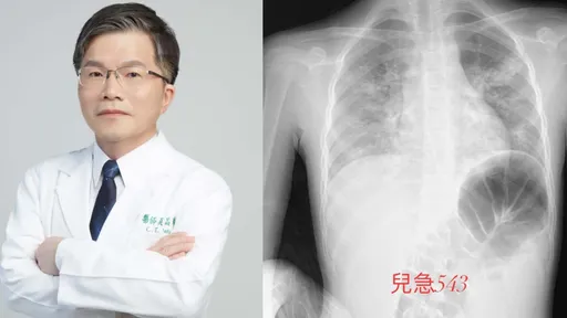 兒醫示警:秋冬3病毒合併流行!估這時間達高峰 快打這疫苗