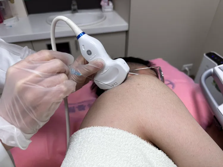 患者右肩盂唇撕裂合併肱骨水腫，接受「超音波導引 PRP (高濃度血小板)注射治療」。圖為情境照，與本文無關 翻攝畫面