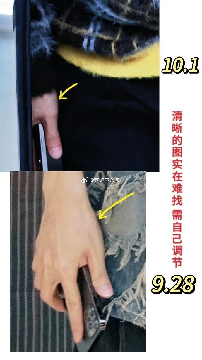 網友表示陳都靈Po的中秋比心照右手手上有個疙瘩，而鄧為手上疑似也有。翻攝甄姬不放瓜微博