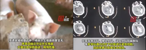 6旬翁餵豬時中風倒地 竟遭啃食下體「生殖器沒了」