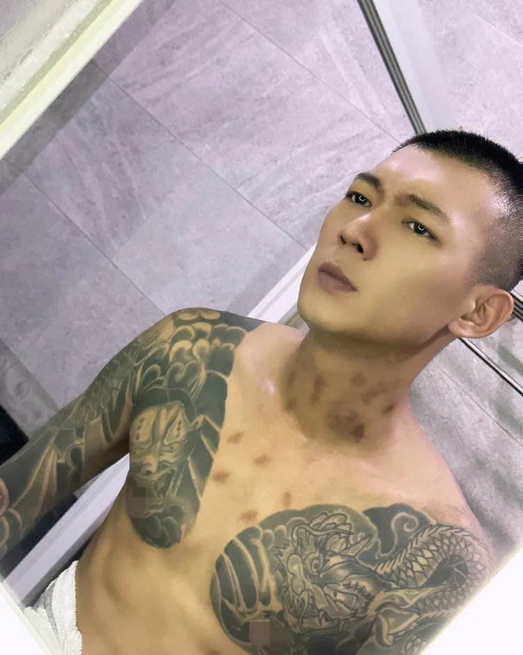 鳳梨胸口和頸部有多個明顯痕跡。翻攝自鳳梨臉書