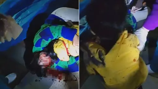 男童晚上10點在家打球　樓下怒了！把他家砍到「父死母殘兒毀容」