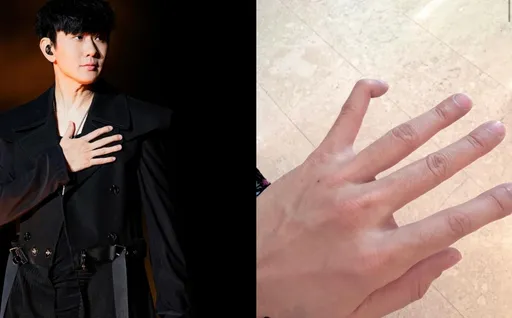 林俊傑「手指90度彎曲」嚴重變形 傷照曝光!網驚:看起來好痛
