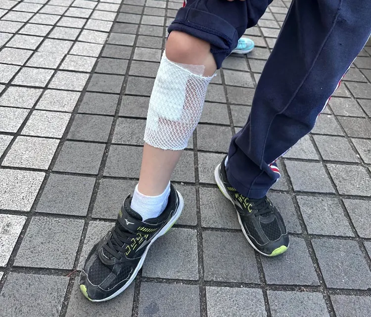 市議員許淑華接獲家長陳情，敦化國小有學生因為活動中心沒錢改善，導致摔倒膝蓋撕裂傷縫3針。