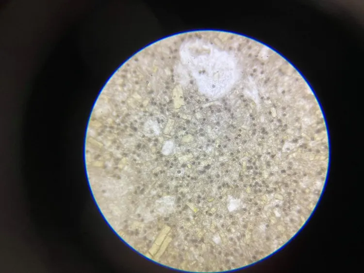 幼貓腸道内寄生蟲球蟲的鏡檢照片。動保處提供