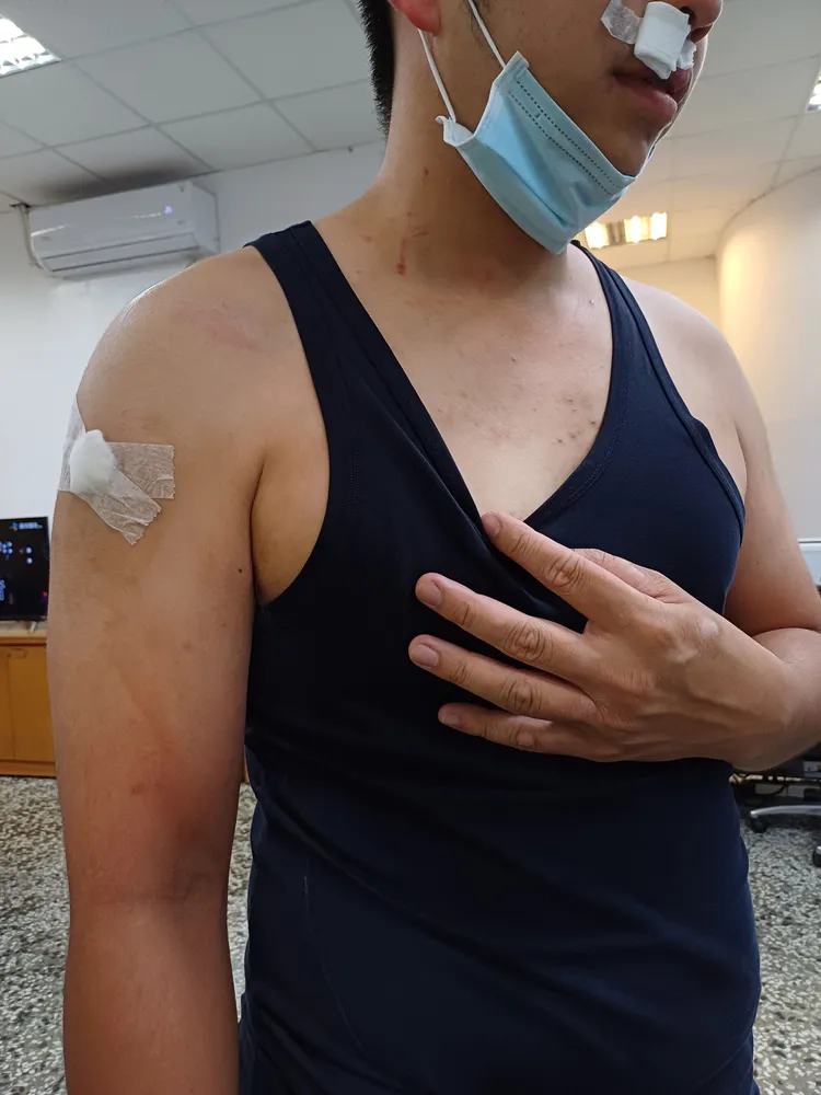 王員面部、四肢受傷。翻攝畫面