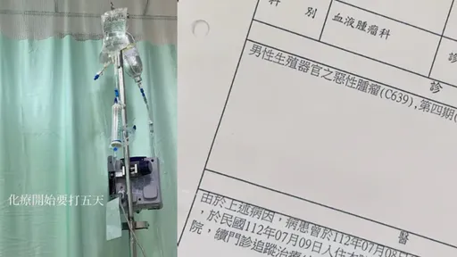 21歲男不抽菸!胸痛就醫「肺部白了一片」 罹癌化療「一輩子只剩一邊肺」