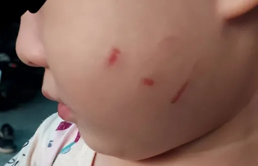 幼童遭強拉還甩巴掌？男師辯不小心抓傷　教育局：調查屬實絕不寬貸