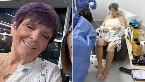 65歲婦拉皮手術「變爆乳翹臀」 她哀號:我不想要大奶