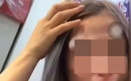 直播賣水果成家暴現場　遭手機K頭！闆娘控夫長期家暴