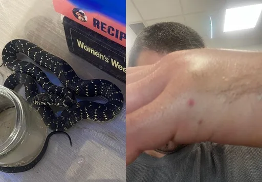 走步道見小蛇竟「喜帶回家當紀念品」 男被咬險些沒命