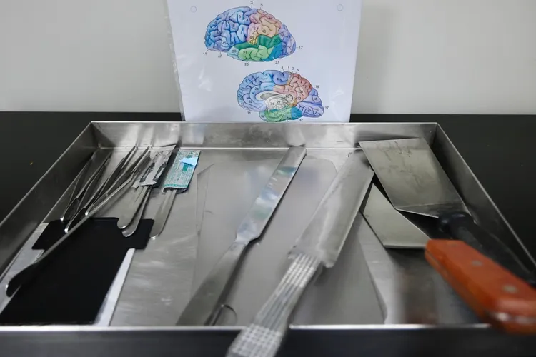 切腦用工具。林林攝