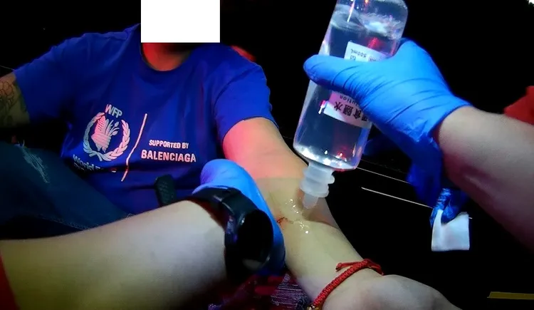 男子幸受輕傷，就醫後已無大礙。消防局提供