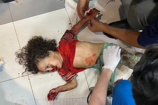 以巴戰火下受害者!世衛:加薩平均每10分鐘就有1孩童喪命