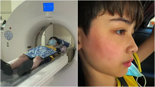 伊萊媽混血兒被同學霸凌痛毆 還罵「為何你考第一名?怎不去死」