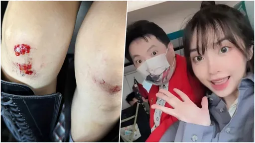 台語歌手腿萎縮！正妹女兒抱父摔傷濺血　他自責：都是我害的