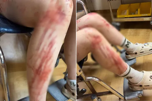 花蓮飛行傘「上月就出事」 她起飛2秒急墜！控業者沒叫救護車：2000元打發