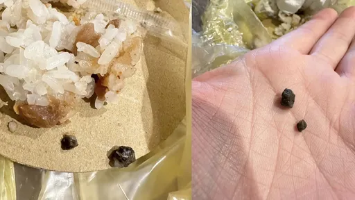 吃飯糰咬到石頭!牙齒斷了 店家回應讓他氣到崩潰大哭