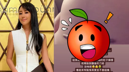 關穎公開肚皮驚悚蟹足腫 膝蓋傷口打針差點跳起來