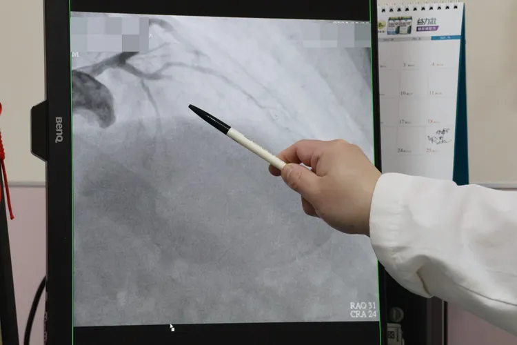 患者總膽固醇超過240mg/dl，低密度膽固醇也超過正常值130mg/dl的1.5倍。院方提供