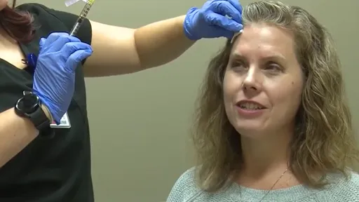 人妻要命偏頭痛竟靠打「肉毒桿菌」緩解 這個「副作用」讓她期待下一針