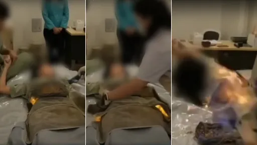 驚悚片|女模治療慘遭「烈火著身」 肚皮燒草藥改善消化引禍