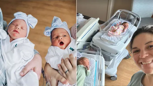 媽媽雙子宮同時懷孕 奇蹟雙胞胎女嬰相隔10小時出生了