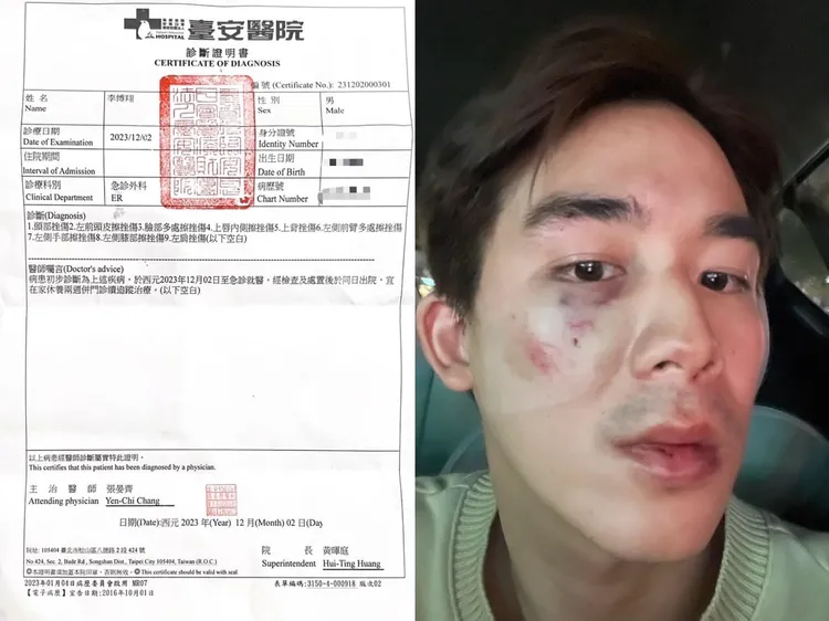 李博翔街頭遭毆傷。取自李博翔社群
