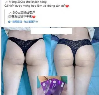 裴女幫客戶打玻尿酸豐臀，還在臉書貼出手術前後對照。民眾提供
