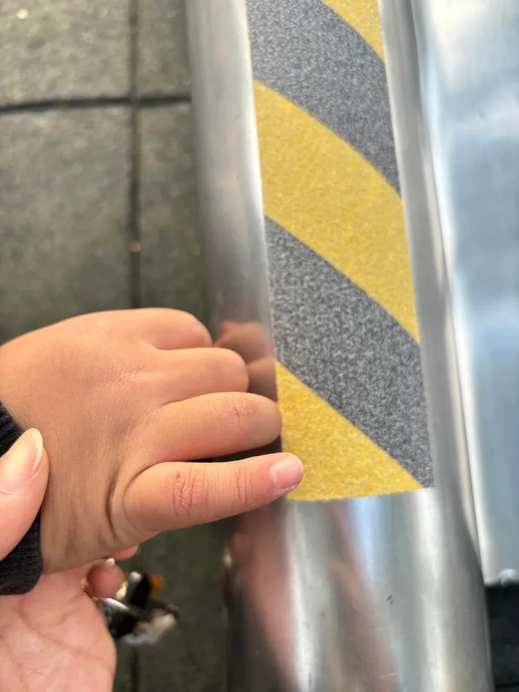 基隆七堵區永平公園溜滑梯作業疏失，將摩擦力大的防滑貼條貼在滑梯扶手上，造成３名孩童受傷見血。取自「我是七堵人交流區」臉書