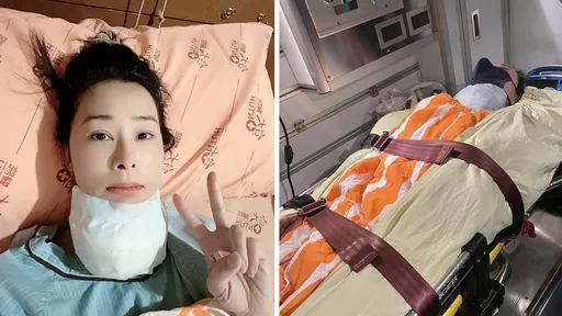 8點檔女星兵家綺開刀被救護車送回病房 自虧嘴巴太小多縫2針