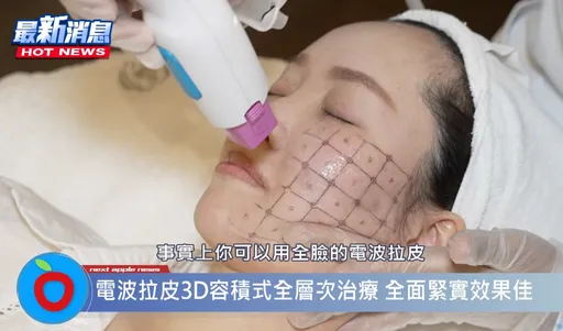 【愛美怕踩雷】電音波緊實療程大不同?!專業皮膚科醫師教你這樣選!