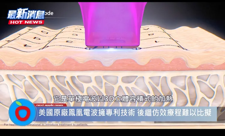 ▲鳳凰電波其實單指美國原廠正宗拉皮，但市面上仿造氾濫。