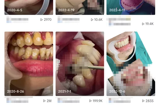 外籍情侶檔當密醫!上網自學治牙po抖音攬客 3年賺20萬下場慘