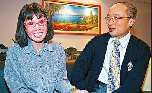 曾兩度來台治療!「穿山甲人」張四妹過世 享壽76歲