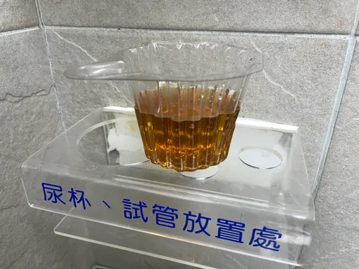 慢性肾病常见4误解!小便泡沫未必蛋白尿 早期治疗防洗肾